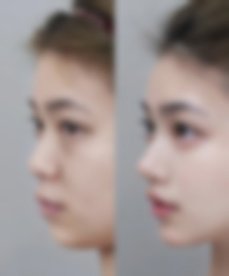 总结——乌鲁木齐美迩美医疗美容整形怎么样？