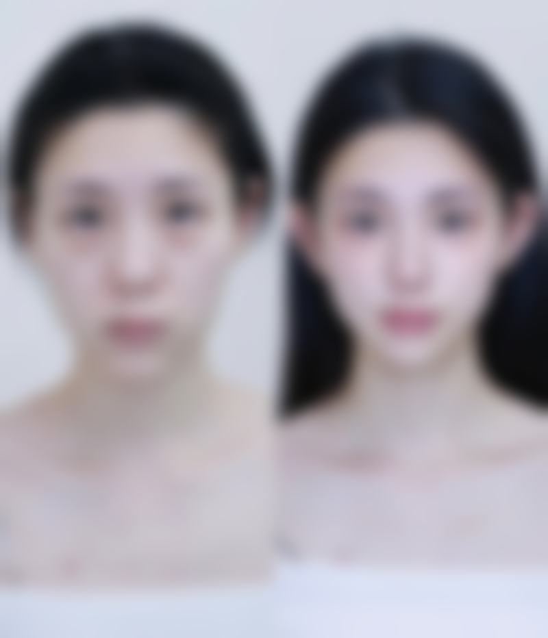 深圳呈悦医疗美容门诊部沈想仁医生技术好不好?