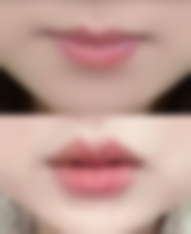 总结——漳州仰德医疗美容门诊部（原维多利亚）怎么样？