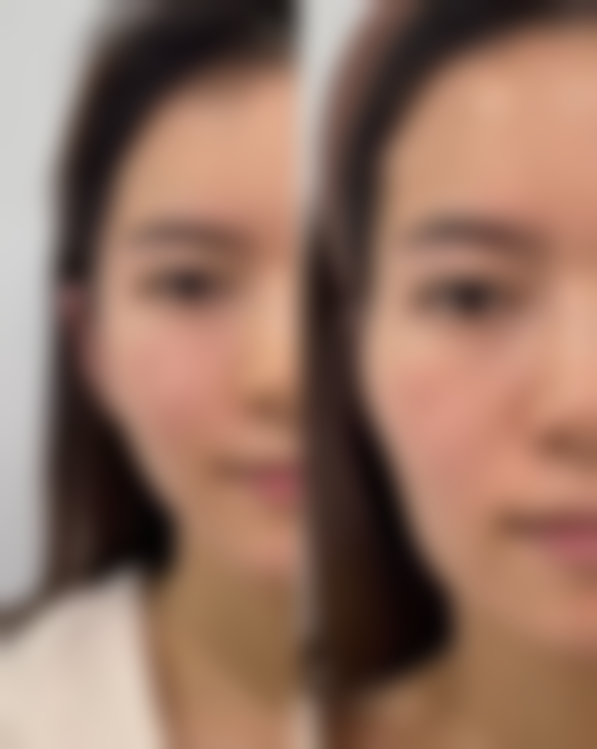 总结——宁波菁漾医疗美容门诊部怎么样？