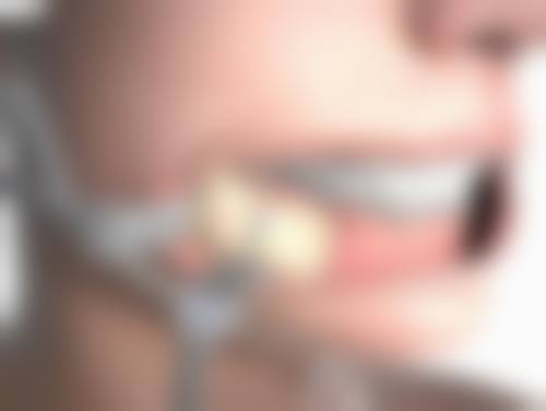 台州昊阳医疗美容门诊部收费标准参考