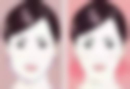 内吸去眼袋和内切去眼袋的风险与并发症