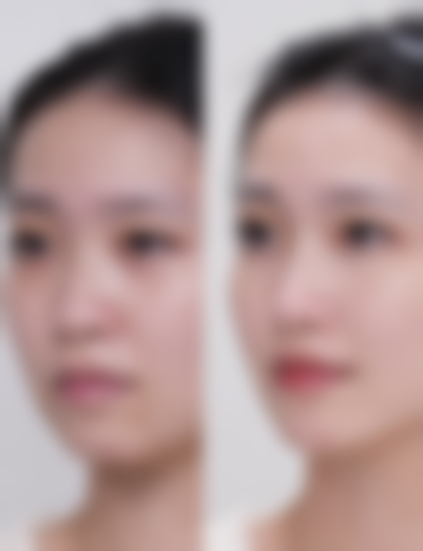 种植头发一个单位的重要性