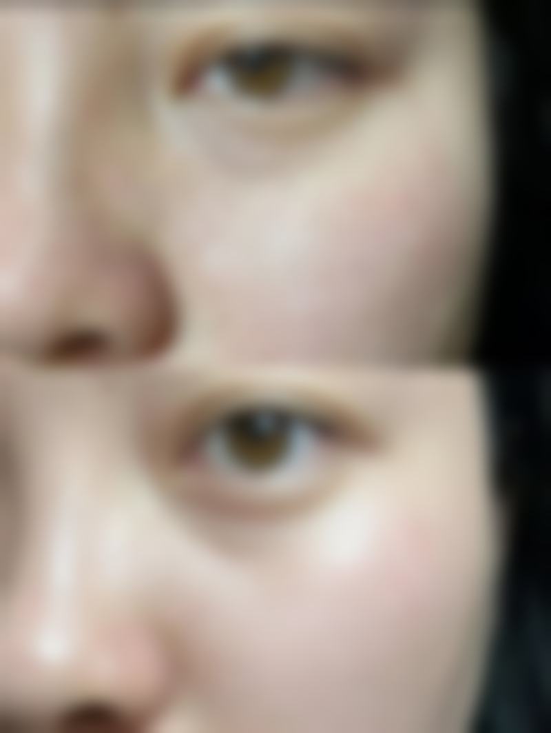 耳软骨和肋骨隆鼻在组织特性方面有什么区别