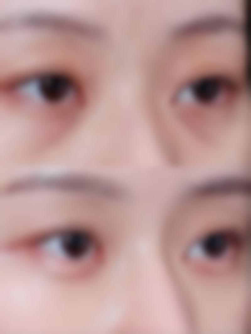 美白针的功效与适用性