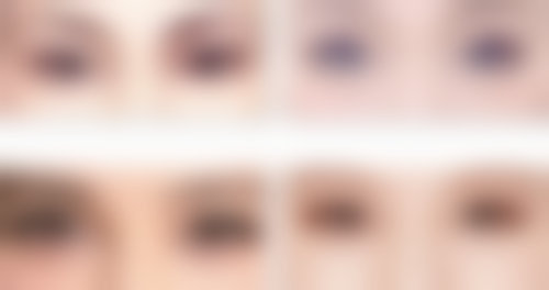 长春奥拉克美容医院医院技术好不好?