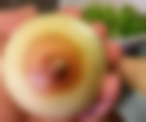 杭州凯丽医疗美容诊所收费标准参考