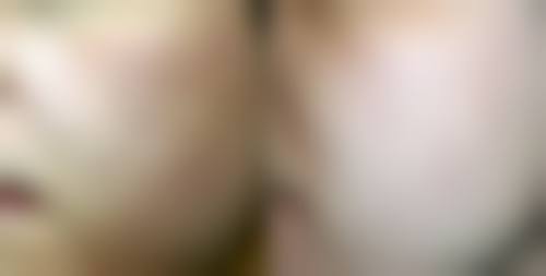 阴唇缩小手术的方式有哪些