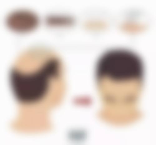 总结——韩国365mc医院朴载宇（釜山院）医生怎么样？