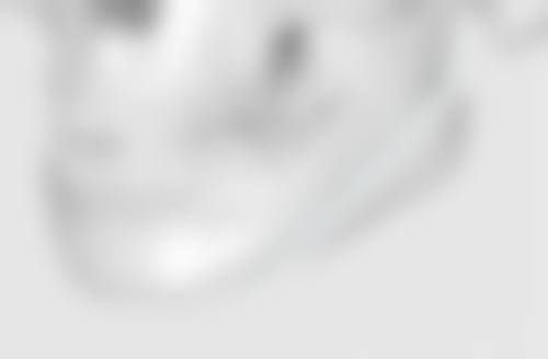 自体脂肪移植丰太阳穴好不好