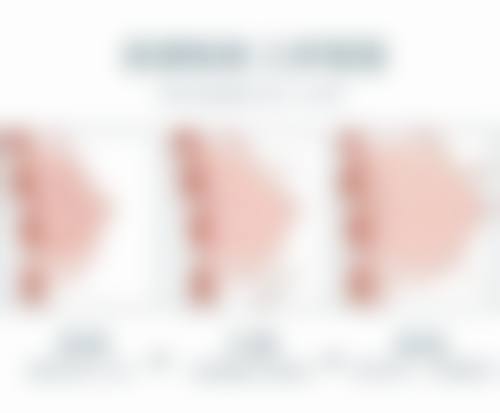 50岁男人去眼袋的物理治疗方法