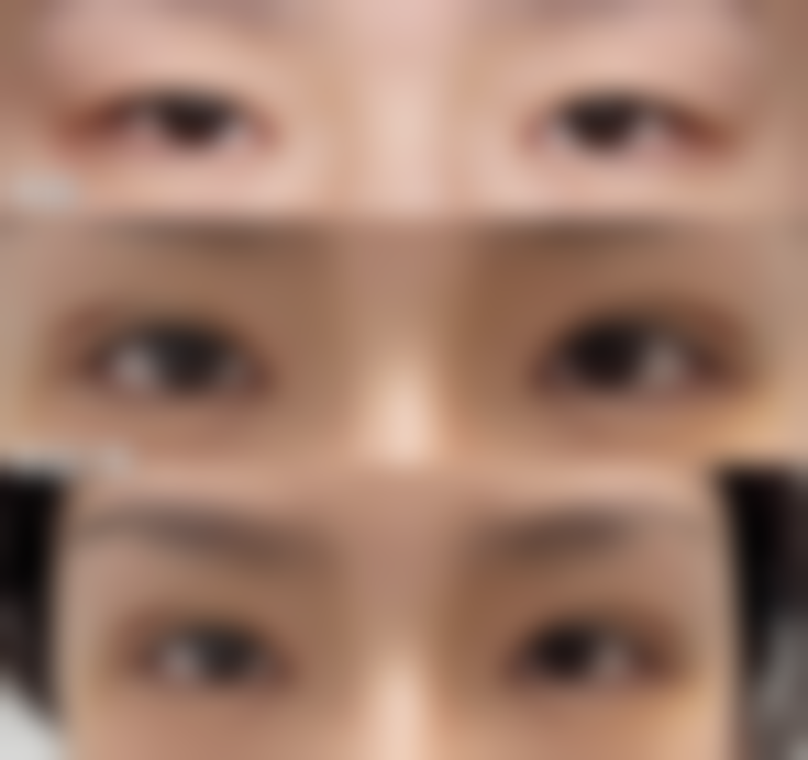 龙岩朝晖美容整形外科诊所收费标准参考