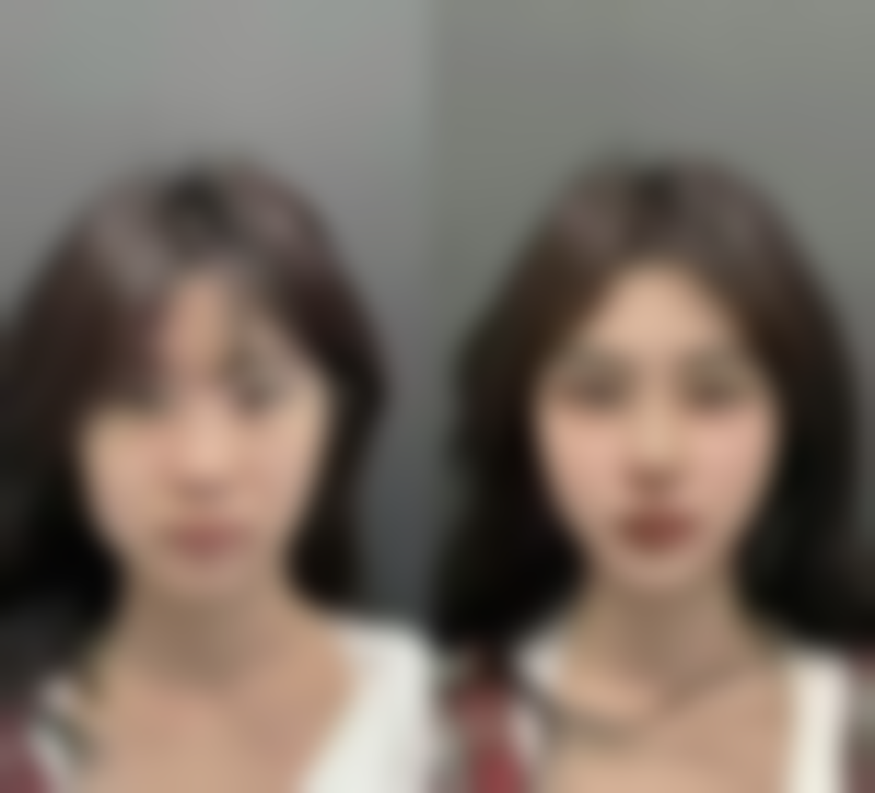 整形手术的价格与风险