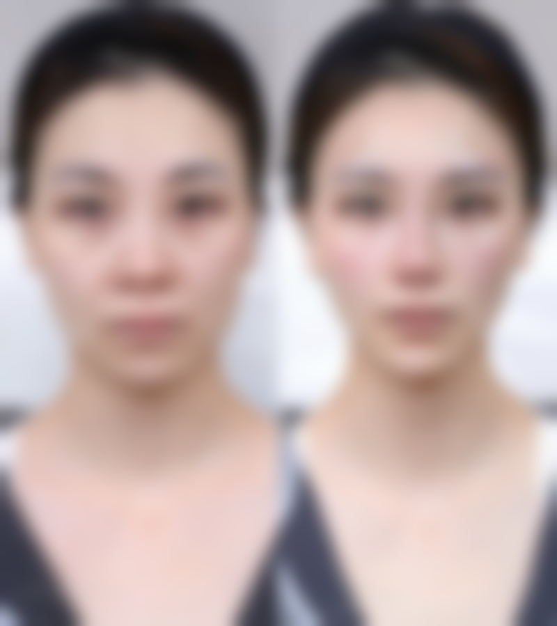 广州拜博整形医疗美容门诊部医院技术好不好？