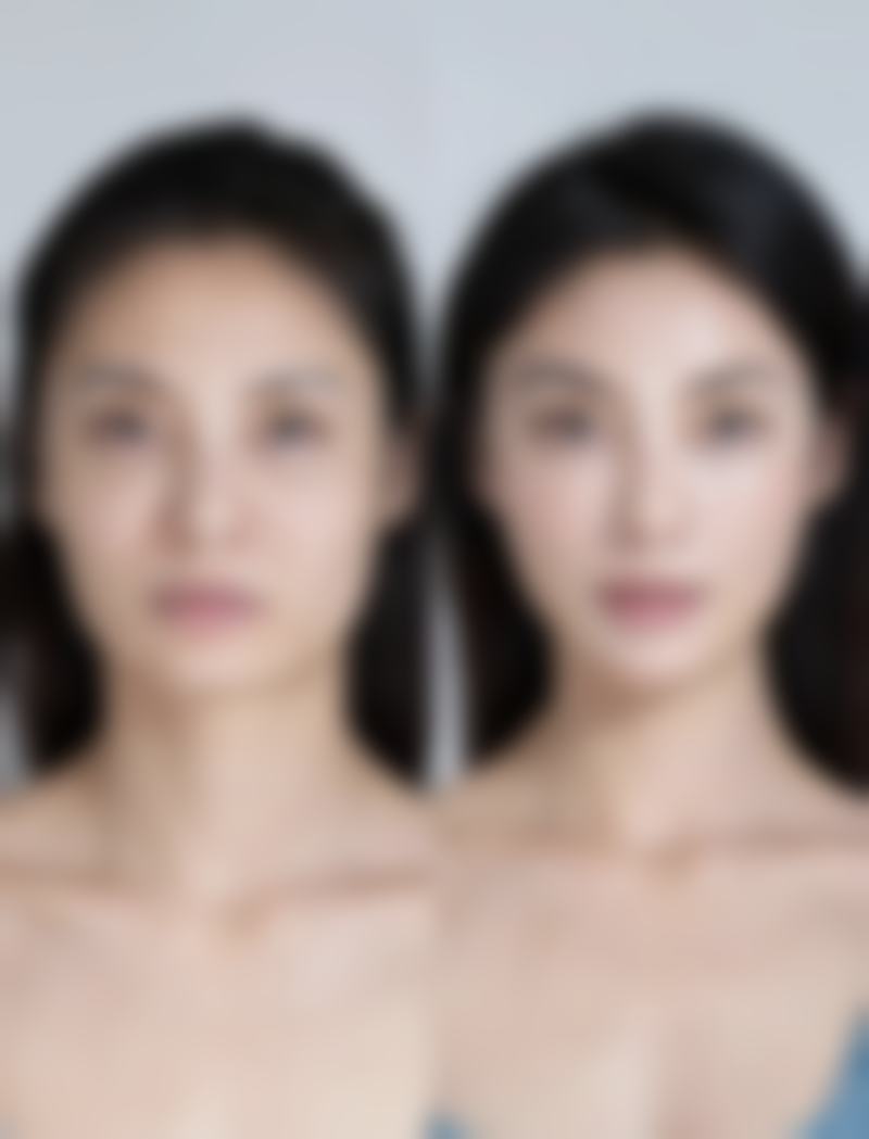 术后护理和注意事项