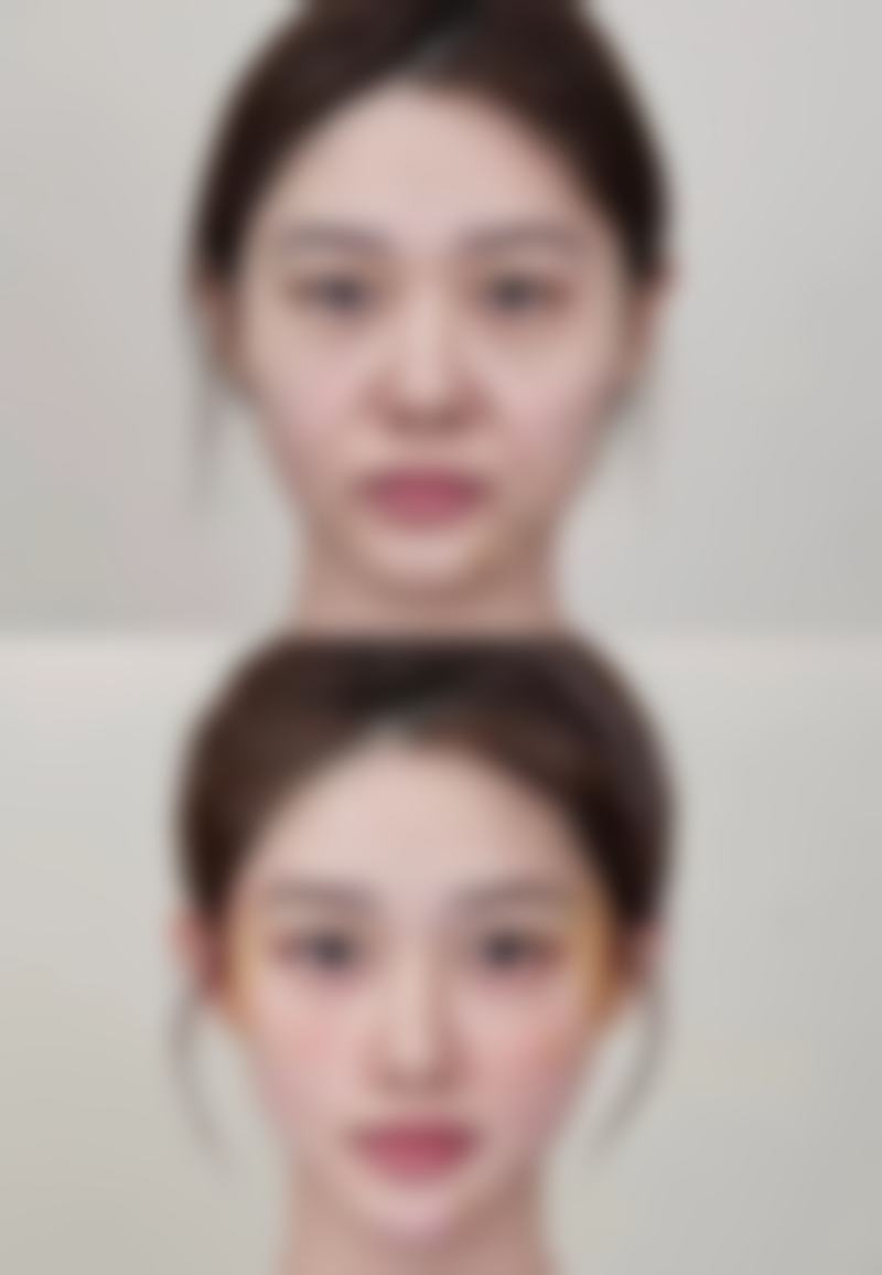 整形后的护理与注意事项