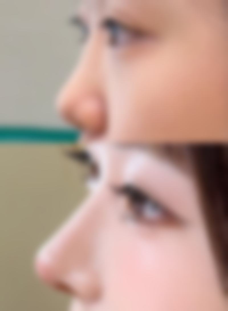 合肥庐阳好肤恒美医疗美容门诊部医院技术好不好？