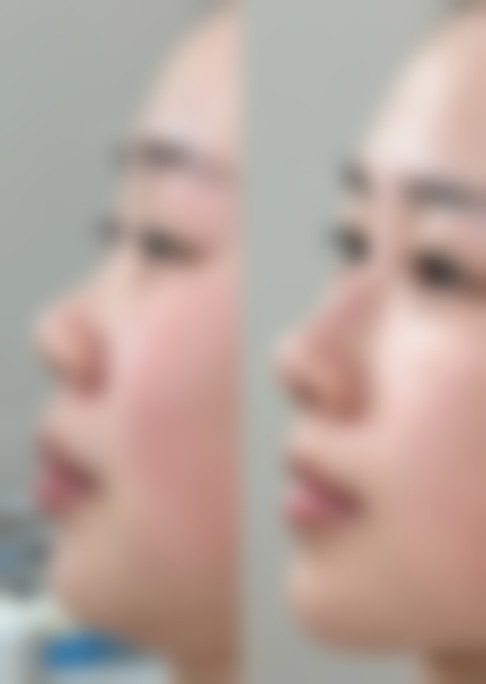 合肥庐阳好肤恒美医疗美容门诊部收费标准参考