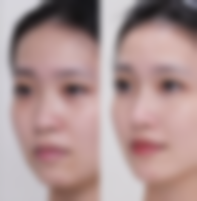 总结——乌鲁木齐红梅医疗美容院怎么样？