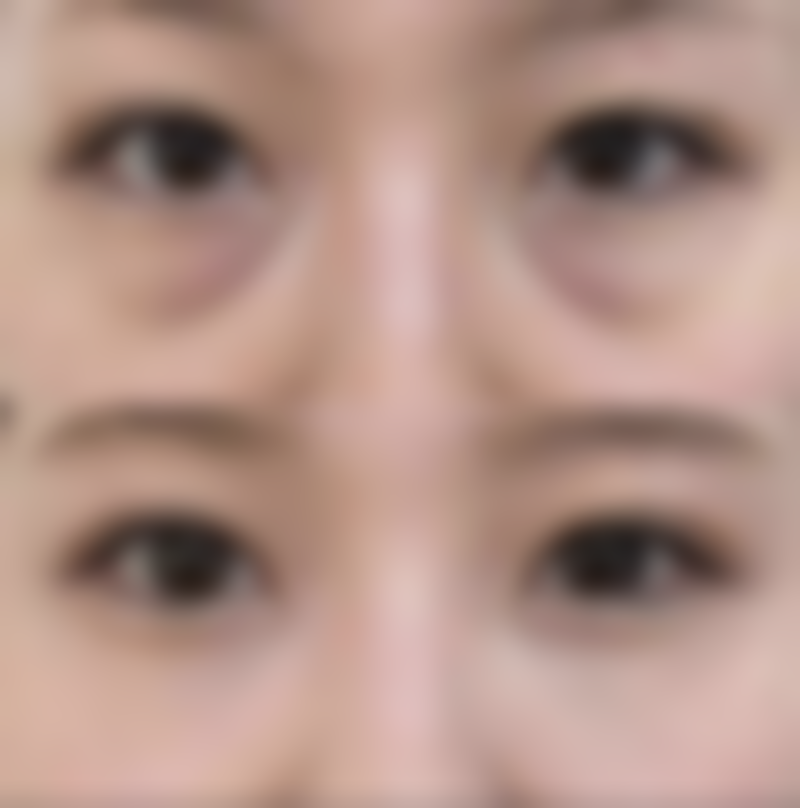 总结——合肥庐阳好肤恒美医疗美容门诊部怎么样？