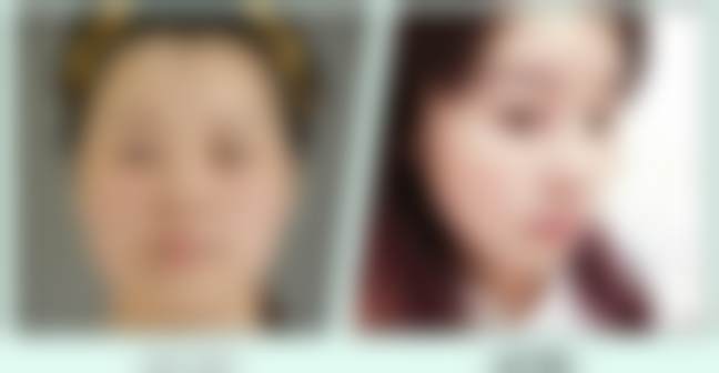 北京禾美嘉医疗美容门诊部任学会医生口碑评价如何?