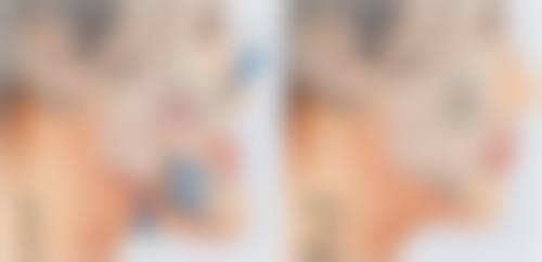 西安致美医疗美容医院收费标准参考