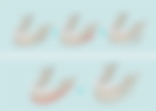 手术风险和注意事项