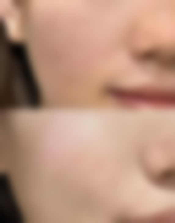 杭州东方整形医院万梦华医生口碑评价如何?