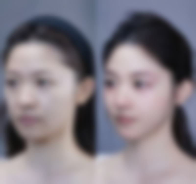 盐山伊妮坊整形医院电话号码及预约方法