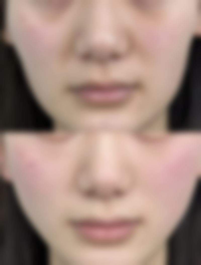 盐山伊妮坊整形医院医院技术好不好?