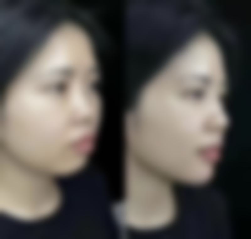 韩国ITEM爱婷整形医院地址