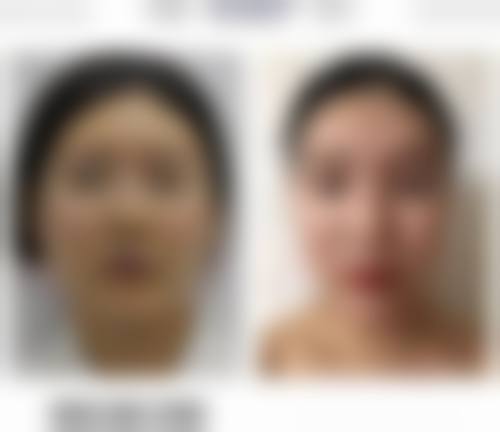 内江文华医疗美容诊所医院技术好不好？