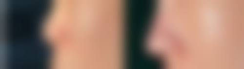 武汉诺颜妍妍子整形医院营业时间