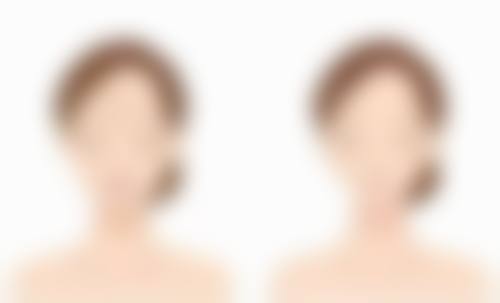 总结——山西莱灵创医疗美容门诊部怎么样?