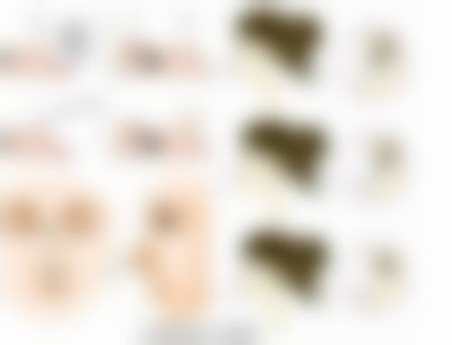 韩国365mc医院朴恩英（江南院）医生技术好不好？