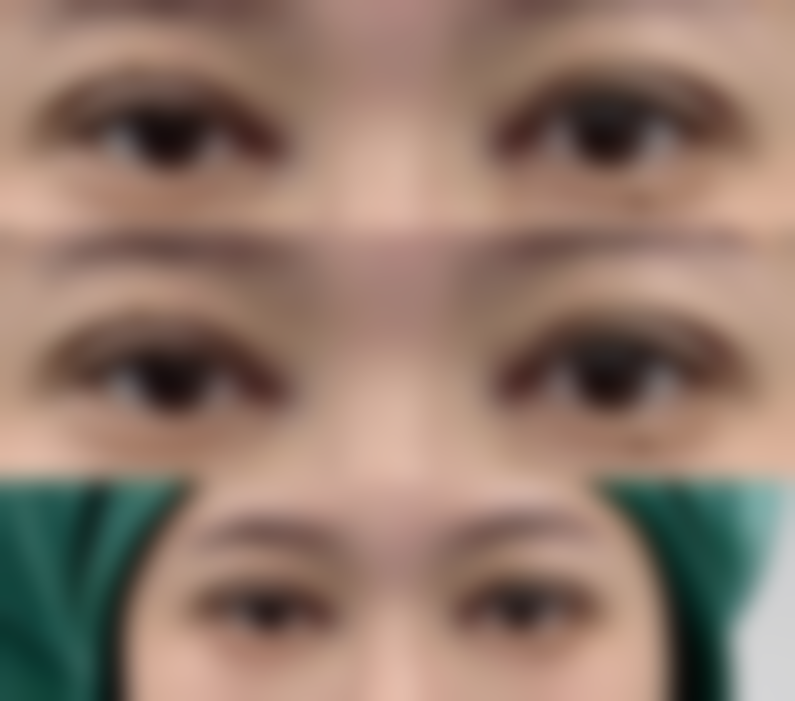 武汉诺颜妍妍子整形医院电话号码及预约方法