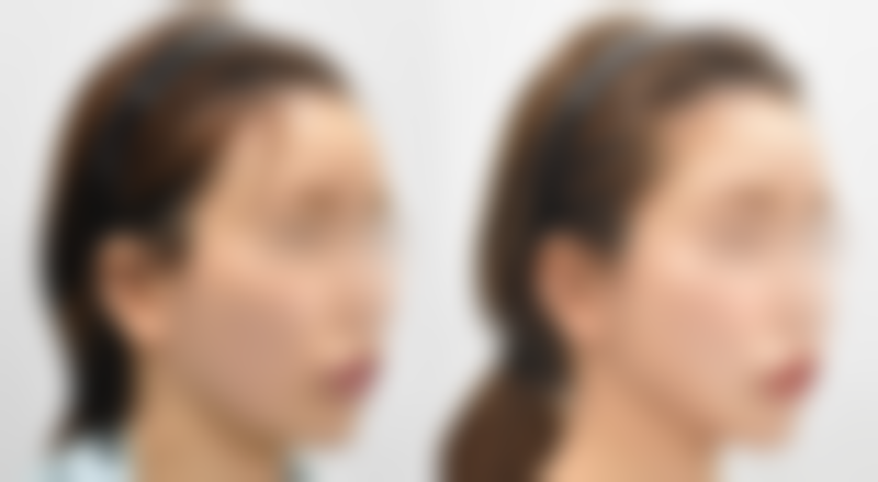 南京艺颜整形医院电话号码及预约方法