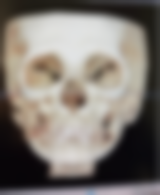 韩国乔颜思(chois)皮肤美容医院电话号码及预约方法