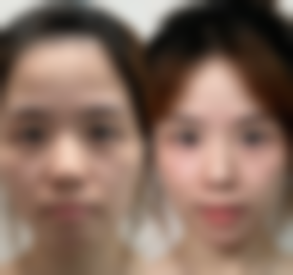 总结——北京亚奇龙医疗整形美容医院怎么样？