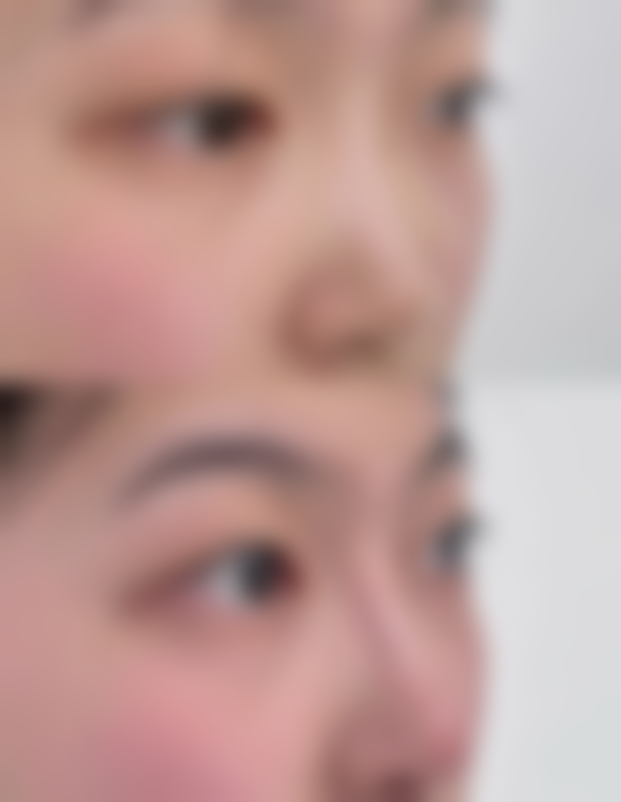 小阴唇缩小手术存在什么风险