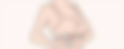 威海丁玉虎整形医院收费标准参考