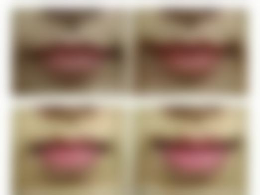 总结——玉林贞韩植发美容皮肤科诊所 怎么样?