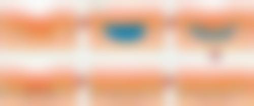 总结——勐海和谐医院皮肤医学美容科怎么样？