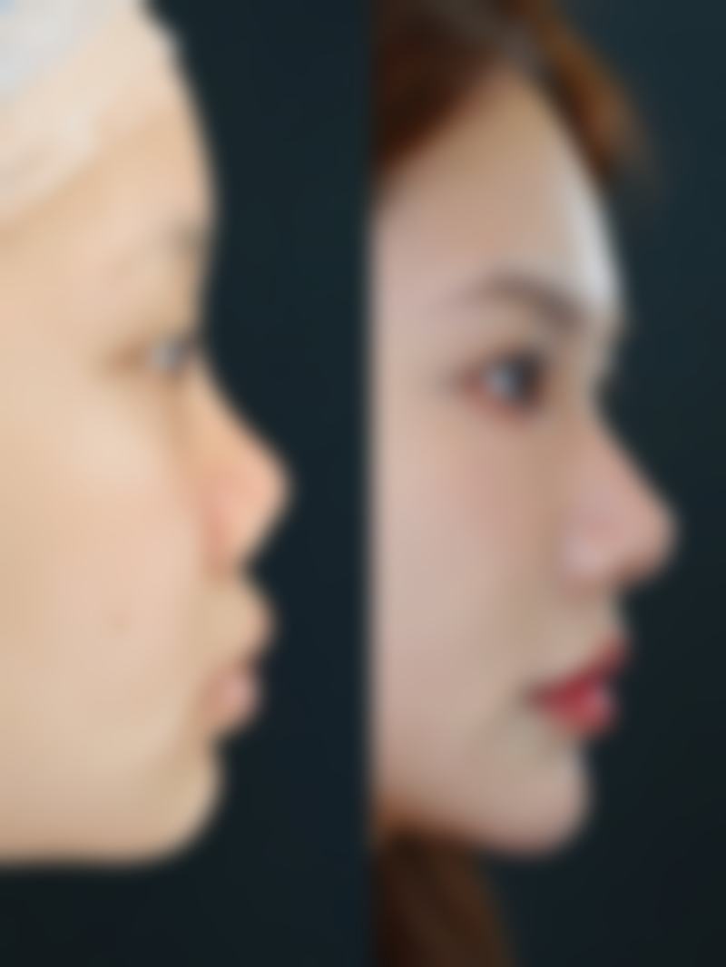 武威亚美美容整形外科诊所口碑如何？