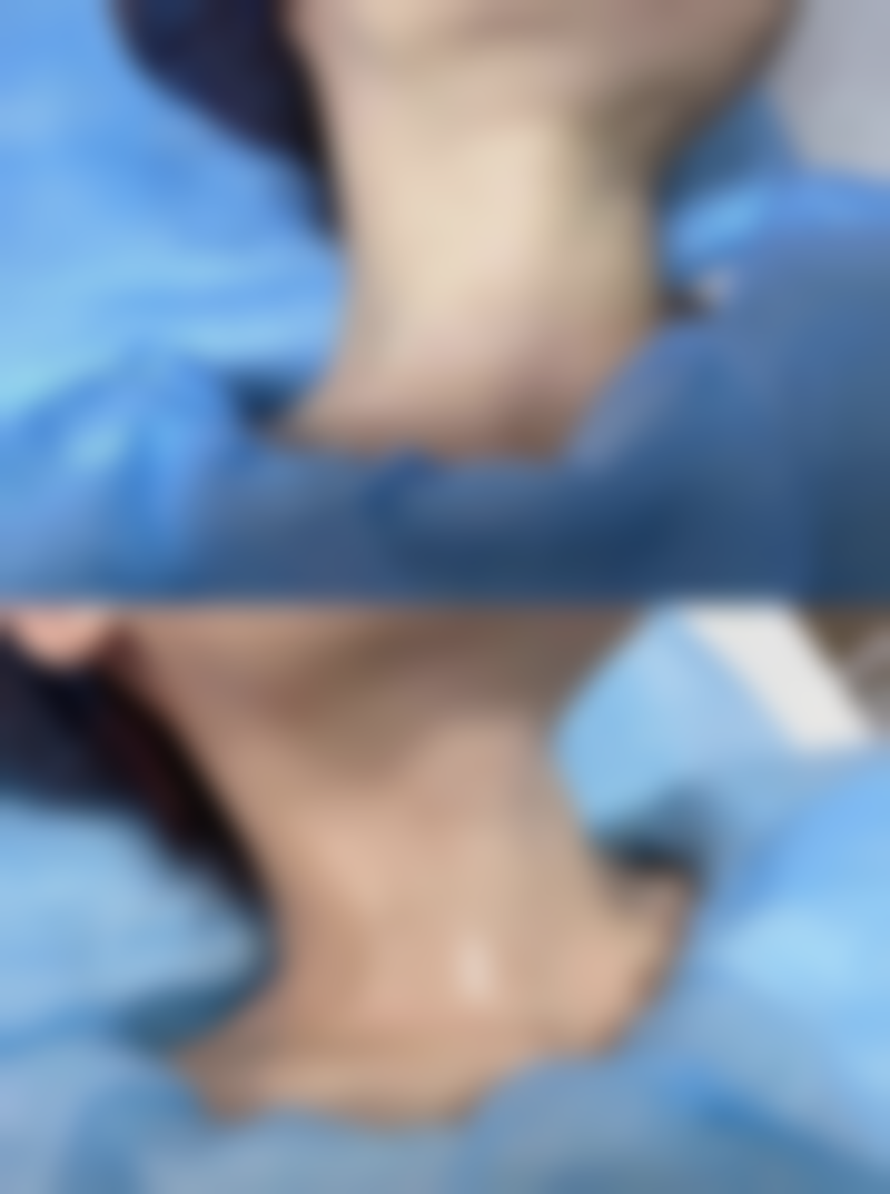 总结——深圳市龙华区人民医院(美容外科)怎么样？