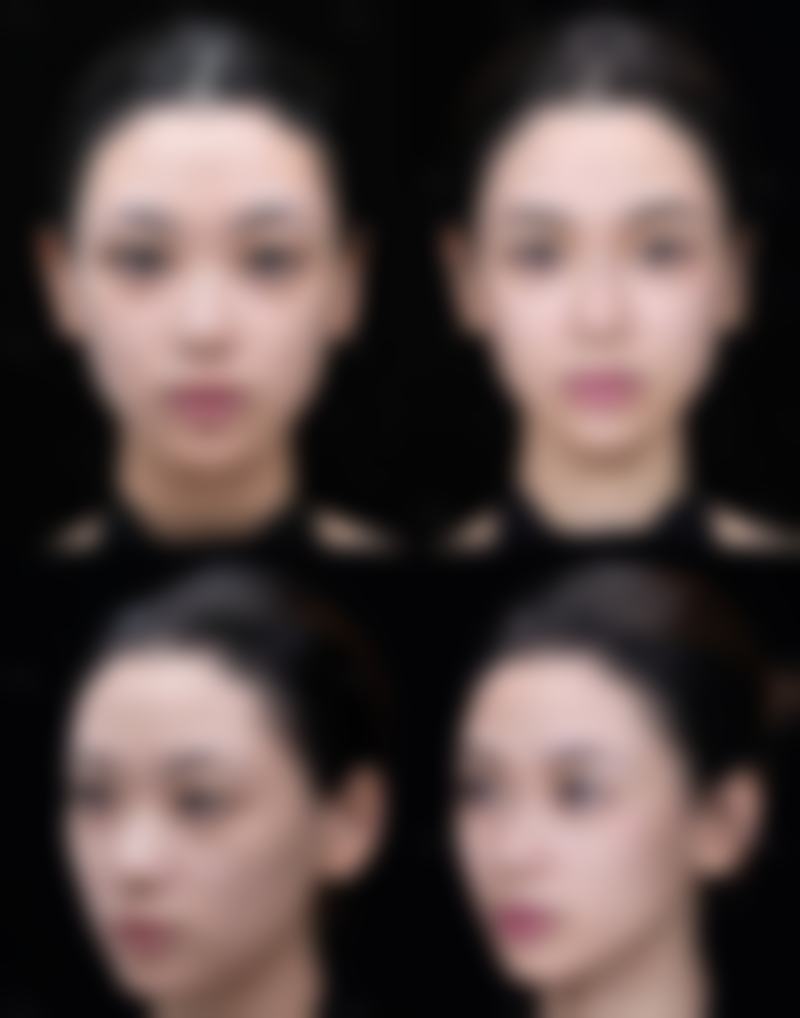 总结——南宁悦美韩星医疗美容门诊部怎么样？