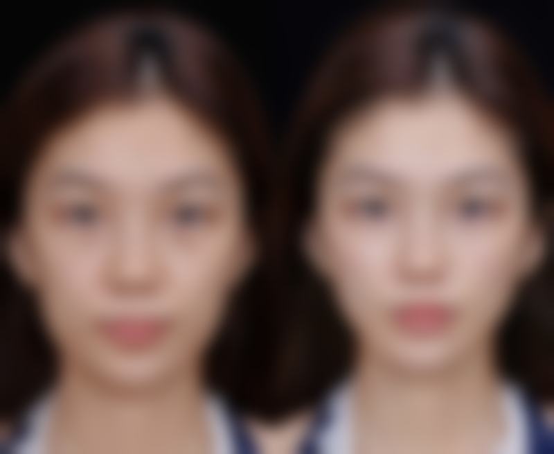 十堰淑梅女子医学整形美容诊所口碑如何？