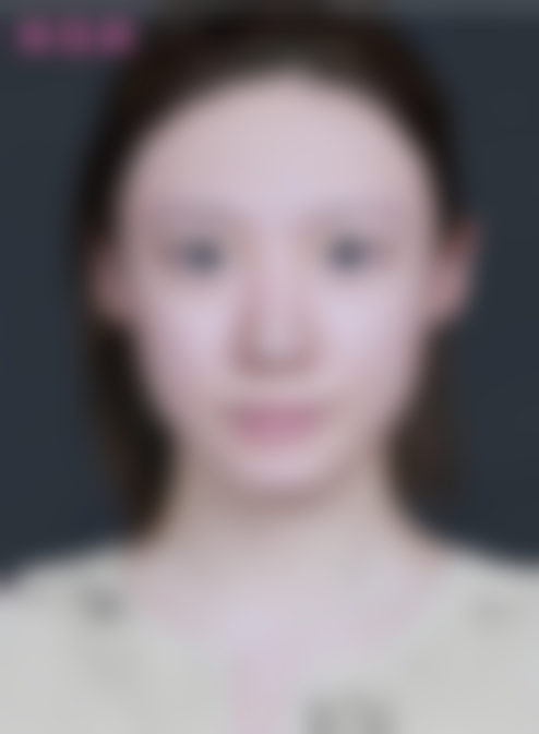 北京米兰柏羽丽都医美赛诺秀5D胶原光激光紧肤5400元起，李晓蓉医生定制方案唤回肌肤年轻态