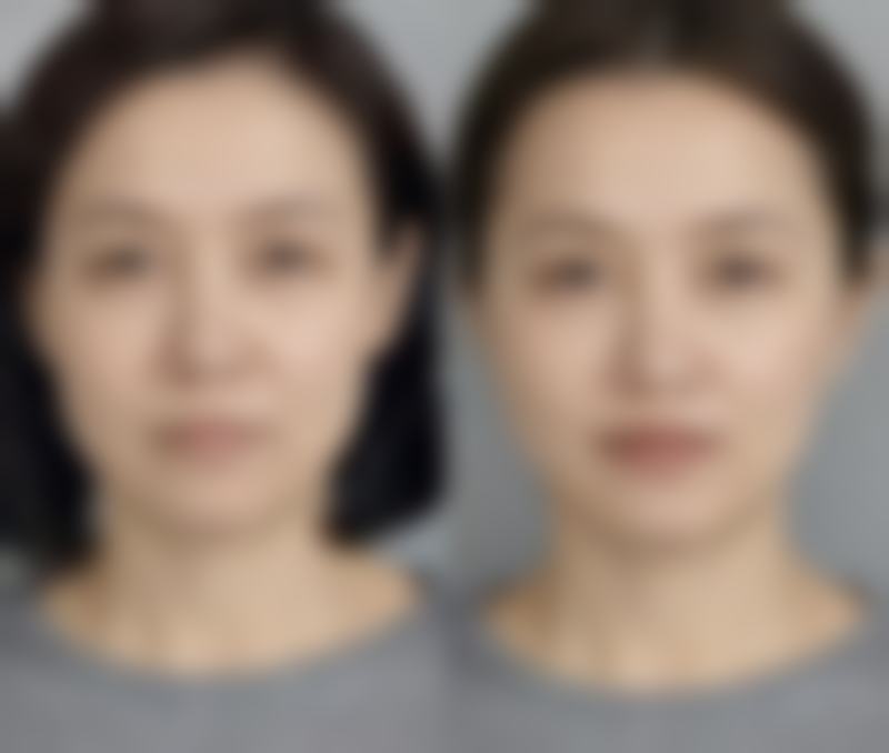 杭州颜术时尚医疗美容诊所口碑如何？