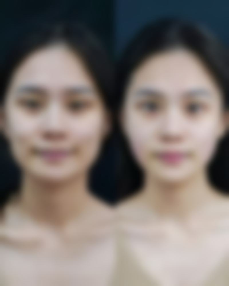 广州积美医疗美容门诊部李灵医生口碑评价如何？